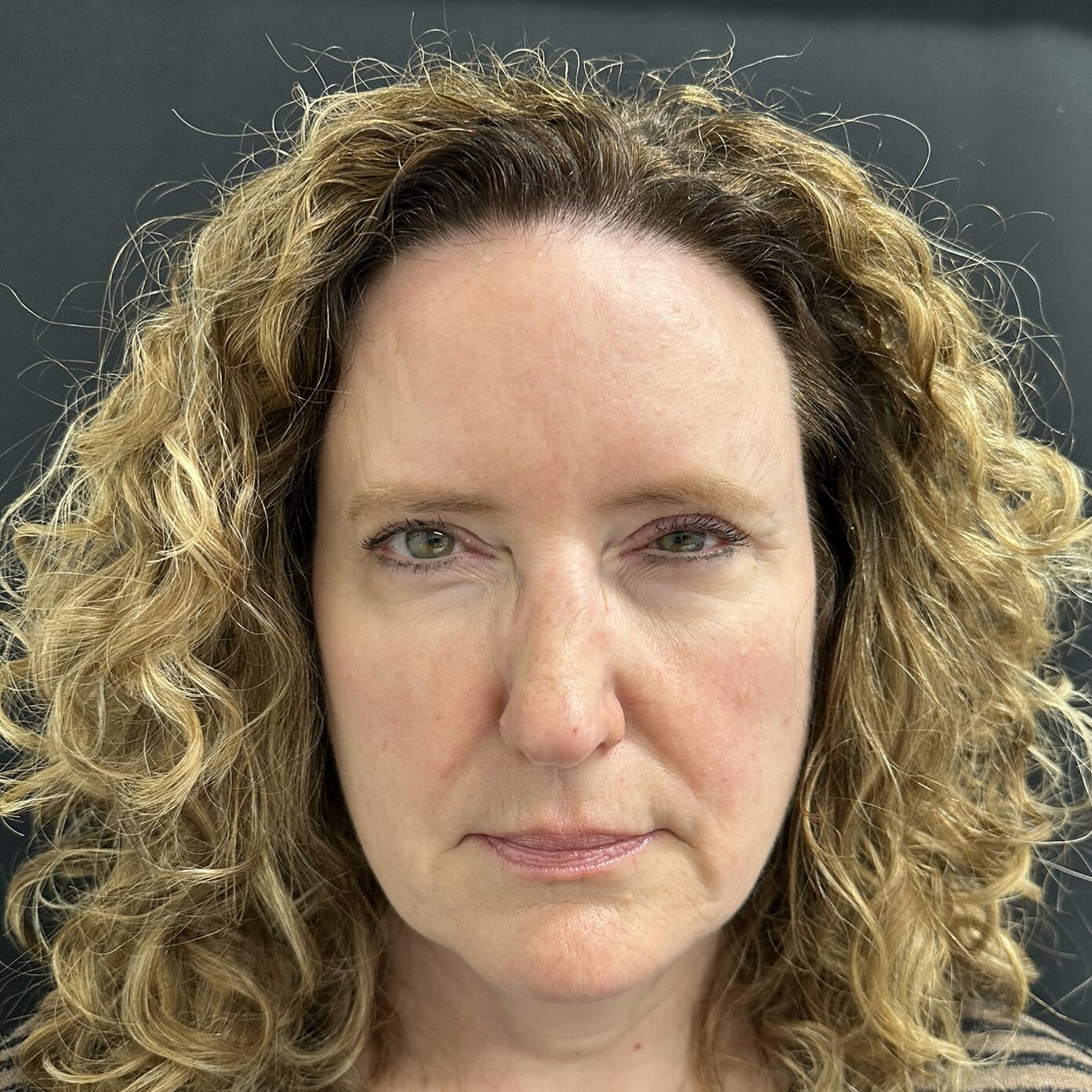 Patient #234 After Image