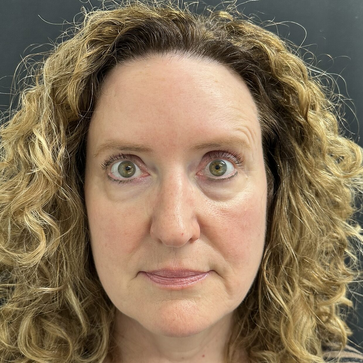 Patient #234 After Image