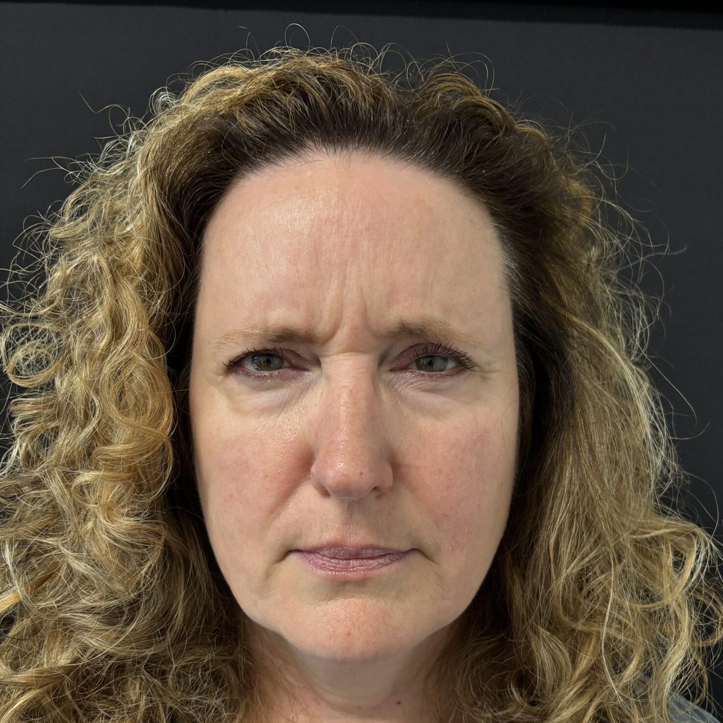 Patient #234 Before Image