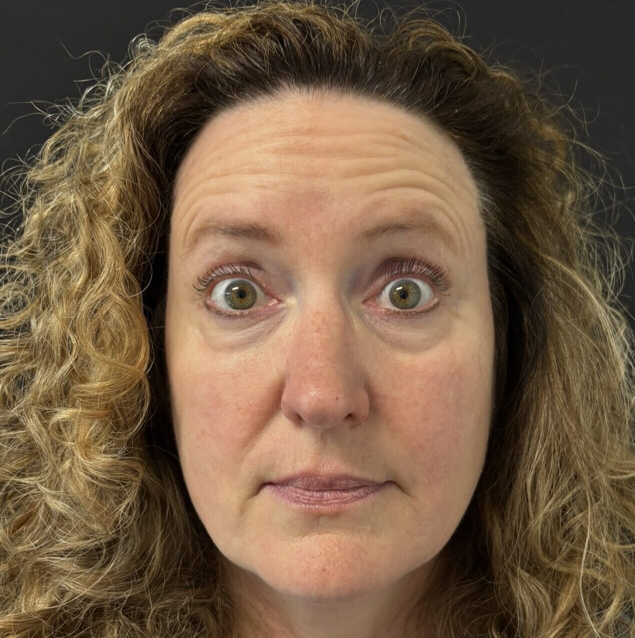 Patient #234 Before Image