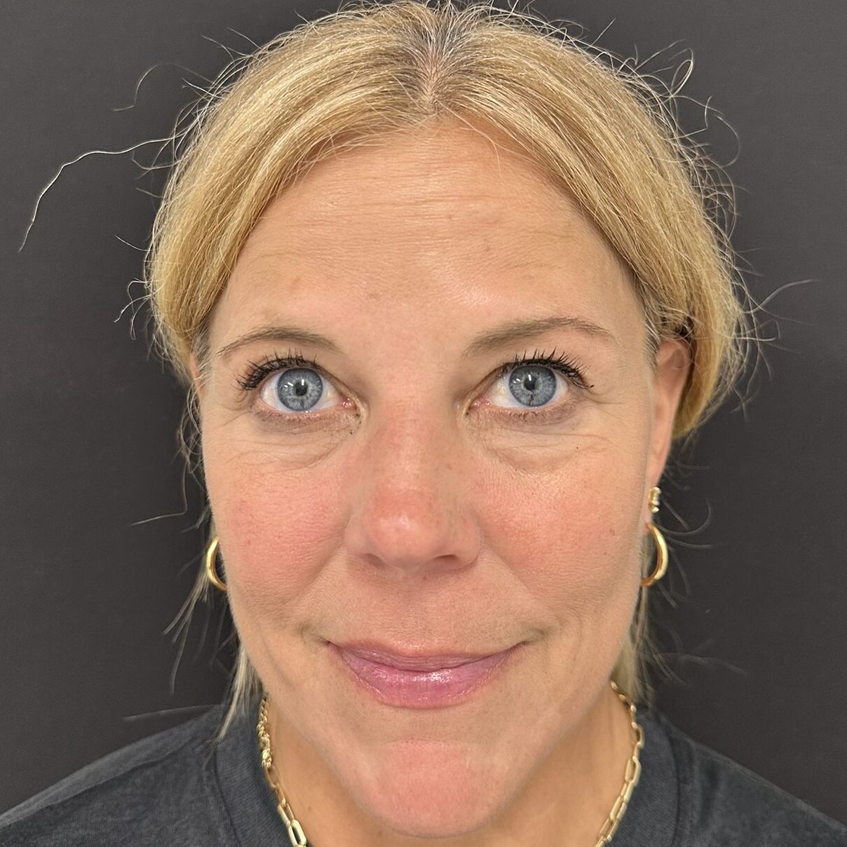 Patient #239 After Image