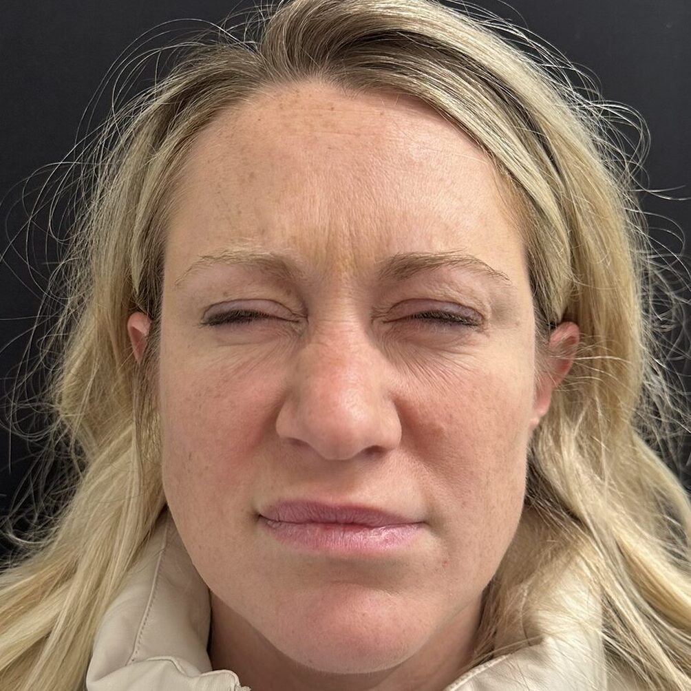 Patient #241 After Image