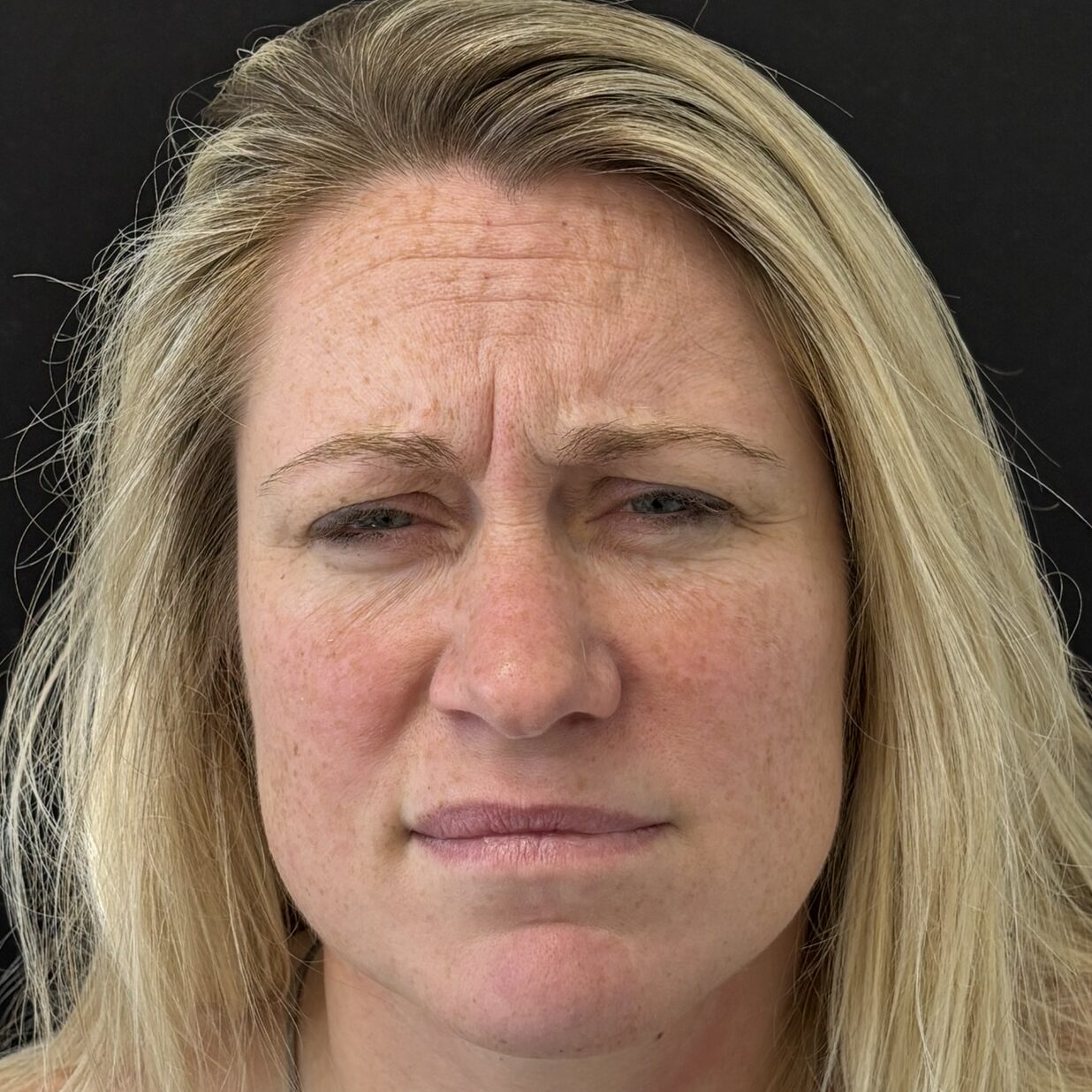 Patient #241 Before Image